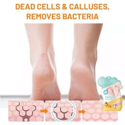 Peeling Foot mask 3