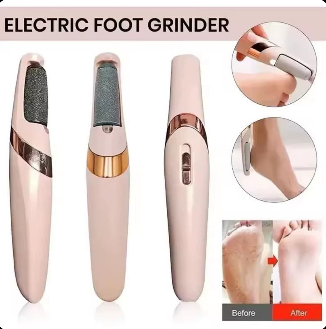 Electric Callous removal